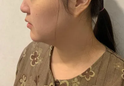 사후관리도 친절히 잘해주셔서 만족합니다.!!