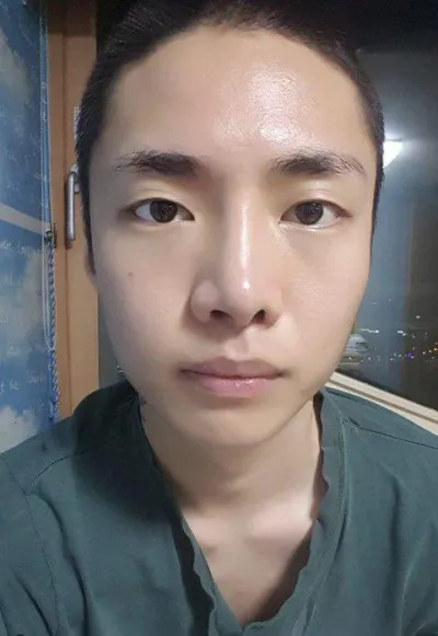 안녕하세요~~ 눈 수술 및 코재수술 후기 입니다!!