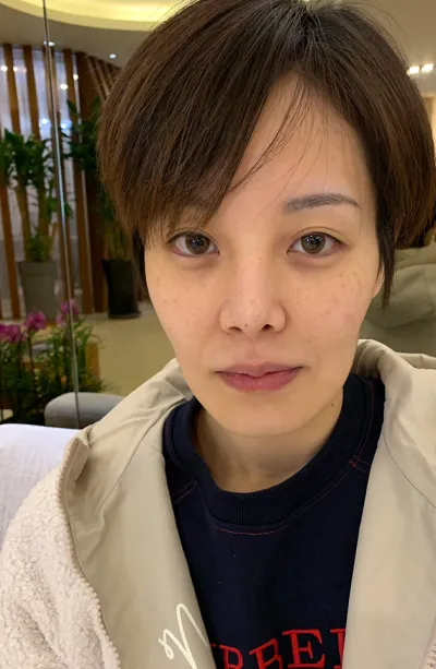 엘라스티꿈 수술받고 6개월뒤 후기 남겨요!!