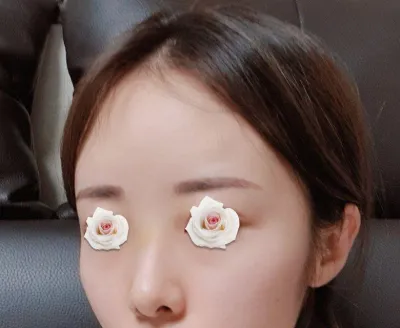 라인대로 이쁘게 해주셔서 지금 너무 만족중이에요.