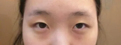 베리굿성형외과 김준현 원장님께 받았어용