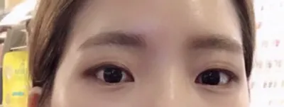 절개로 쌍수한지 5주~6주 정도 된 후기 입니다ㅋㅋㅋ