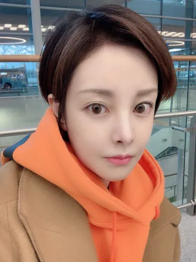 벌써 수술한지 한달반이에요!