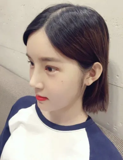 광대수술 2주차예요!!