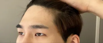 눈 | 리프팅 수술후기