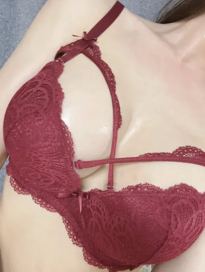 멜론성형외과 재수술 가슴후기