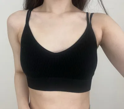 멜론성형외과 1달차 후기