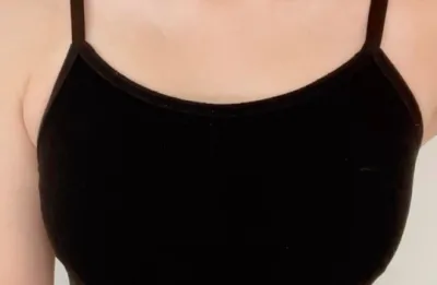 모티바2달) 가끔은 수술한거 까먹을때도 있습니다