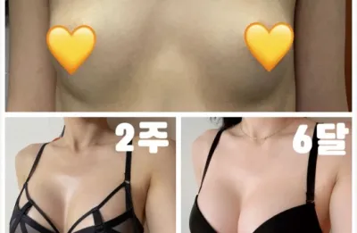 세빈서브 6달) 1년차가 기다려 집니다 :)