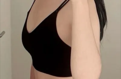 모티바1달차 후기) 금요일 수술, 월요일 출근!