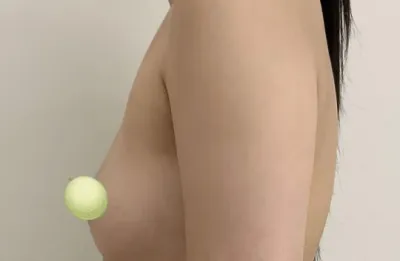 제 흉터가 제일 작고 안 보여요 ㅋㅋ