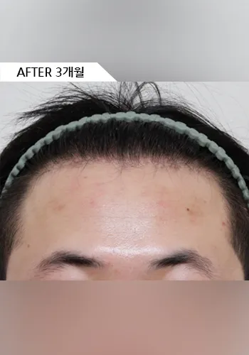 After
