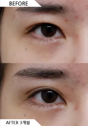 Before