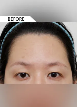 Before