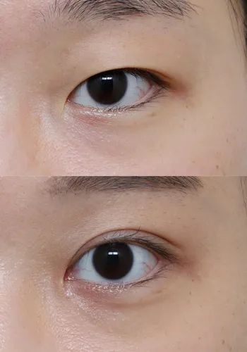 After