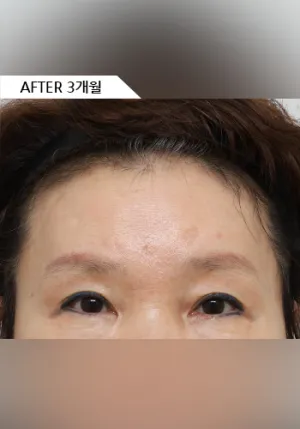 After