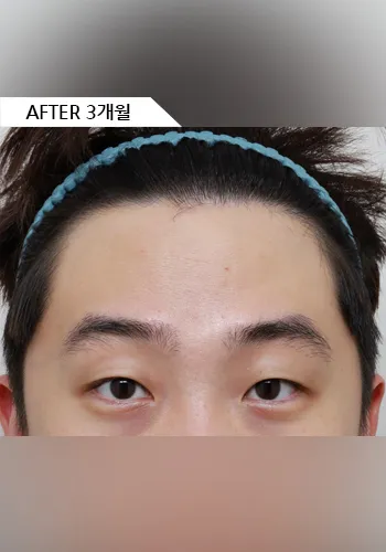 After