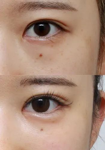 After