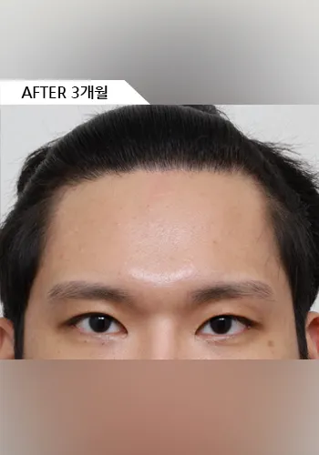 After