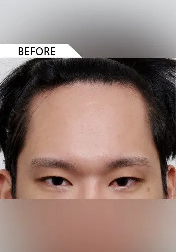 Before