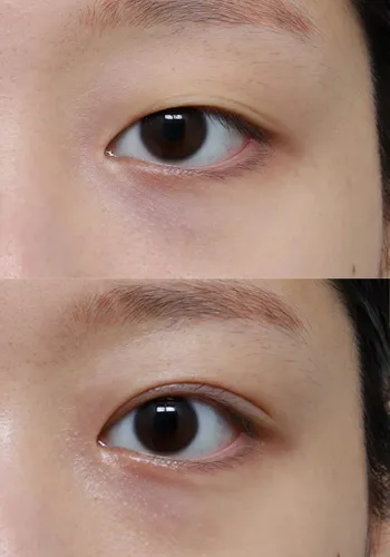 After
