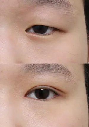 After