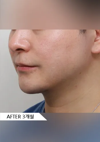 After