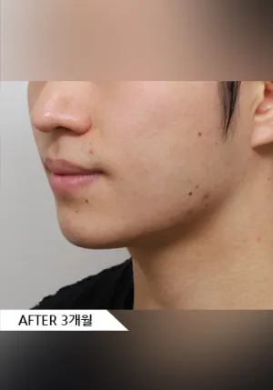 After