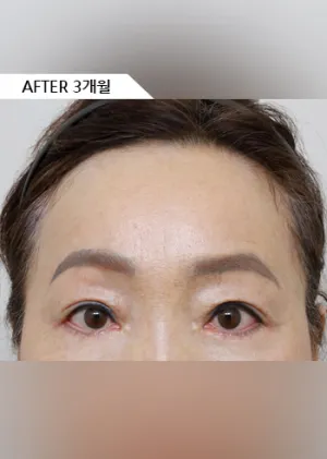 After