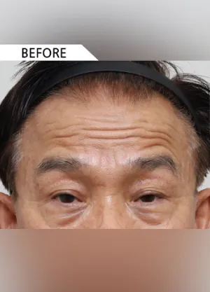 Before