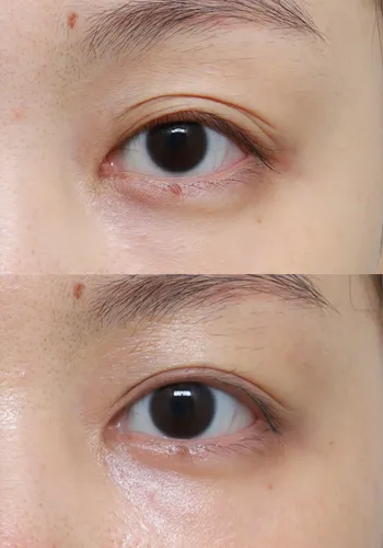 After