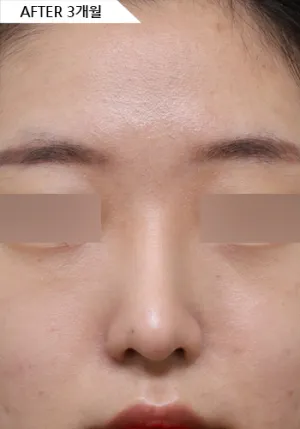 After