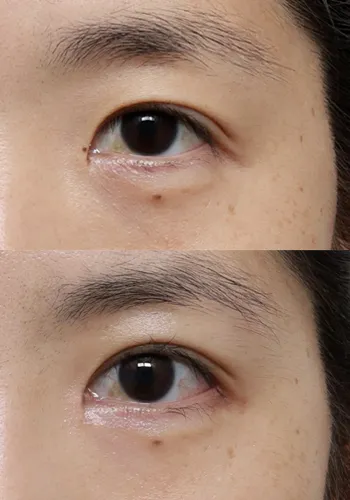 After