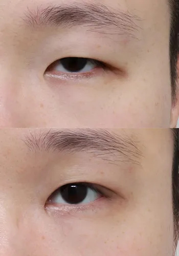 After