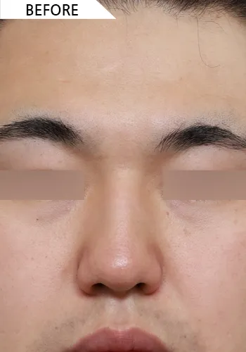 Before