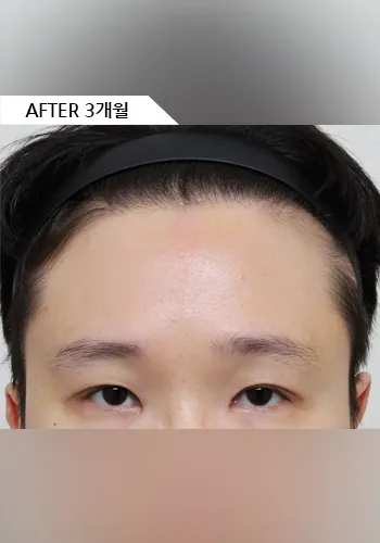 After