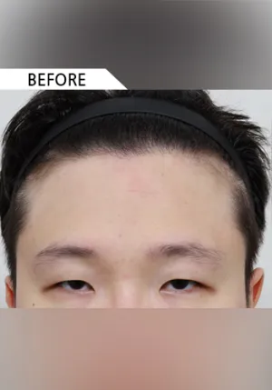 Before