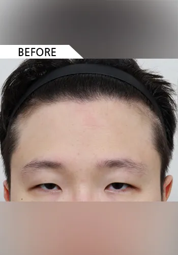 Before