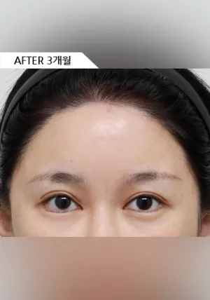 After