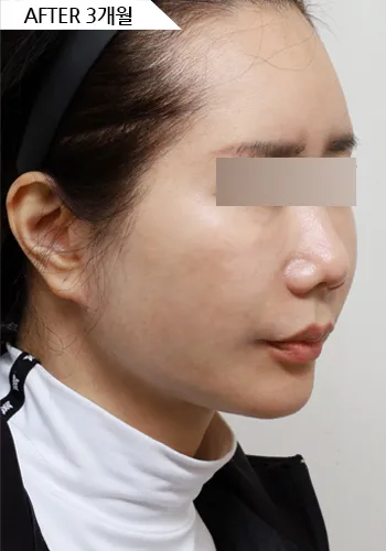 After