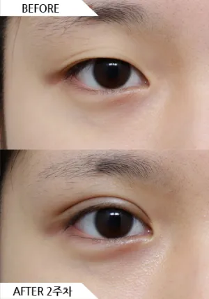 Before