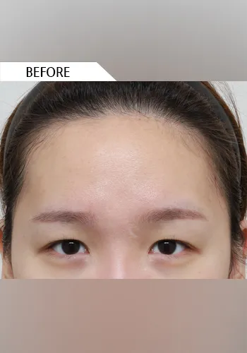 Before