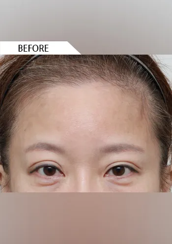 Before