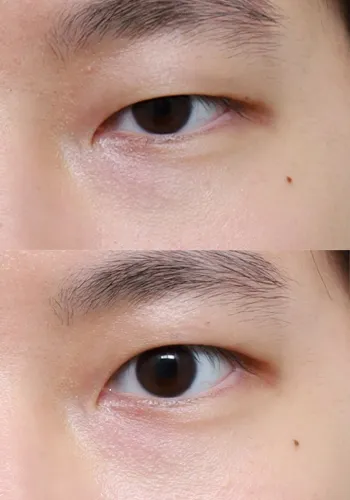 After