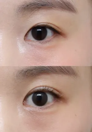 After