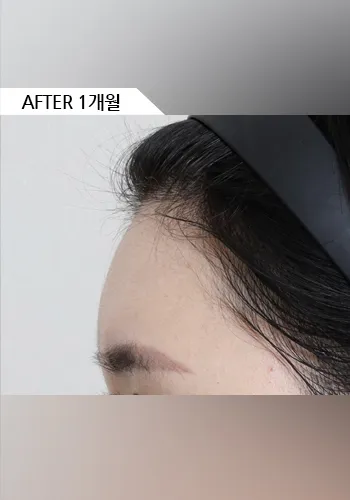 After