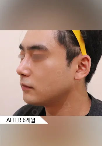 After