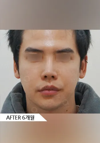 After