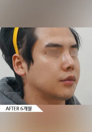 After
