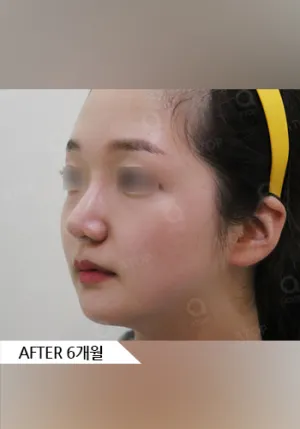 After